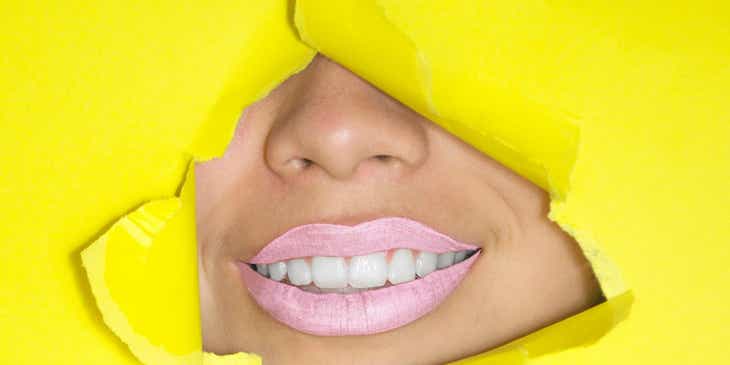 Boca sonriente con lápiz labial rosa y dientes blanqueados emergiendo de un panel amarillo en un negocio de blanqueamiento dental.