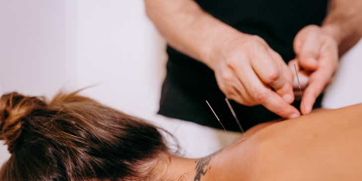 Ein Akupunkteur sticht Nadeln in den Rücken einer auf dem Bauch liegenden Frau.