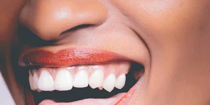 Een lachende persoon die de resultaten van tandenbleken laat zien.